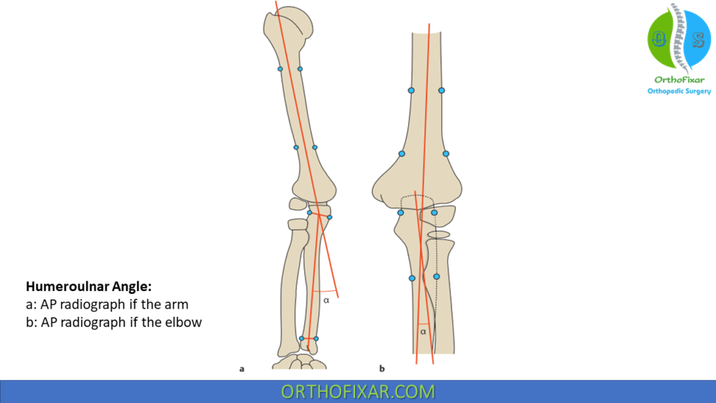 Carrying Angle Of Elbow OrthoFixar 2023