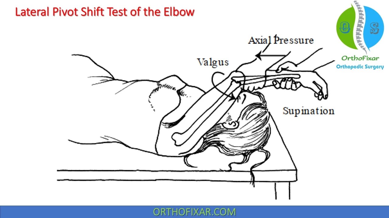 Pivot Shift Test Youtube