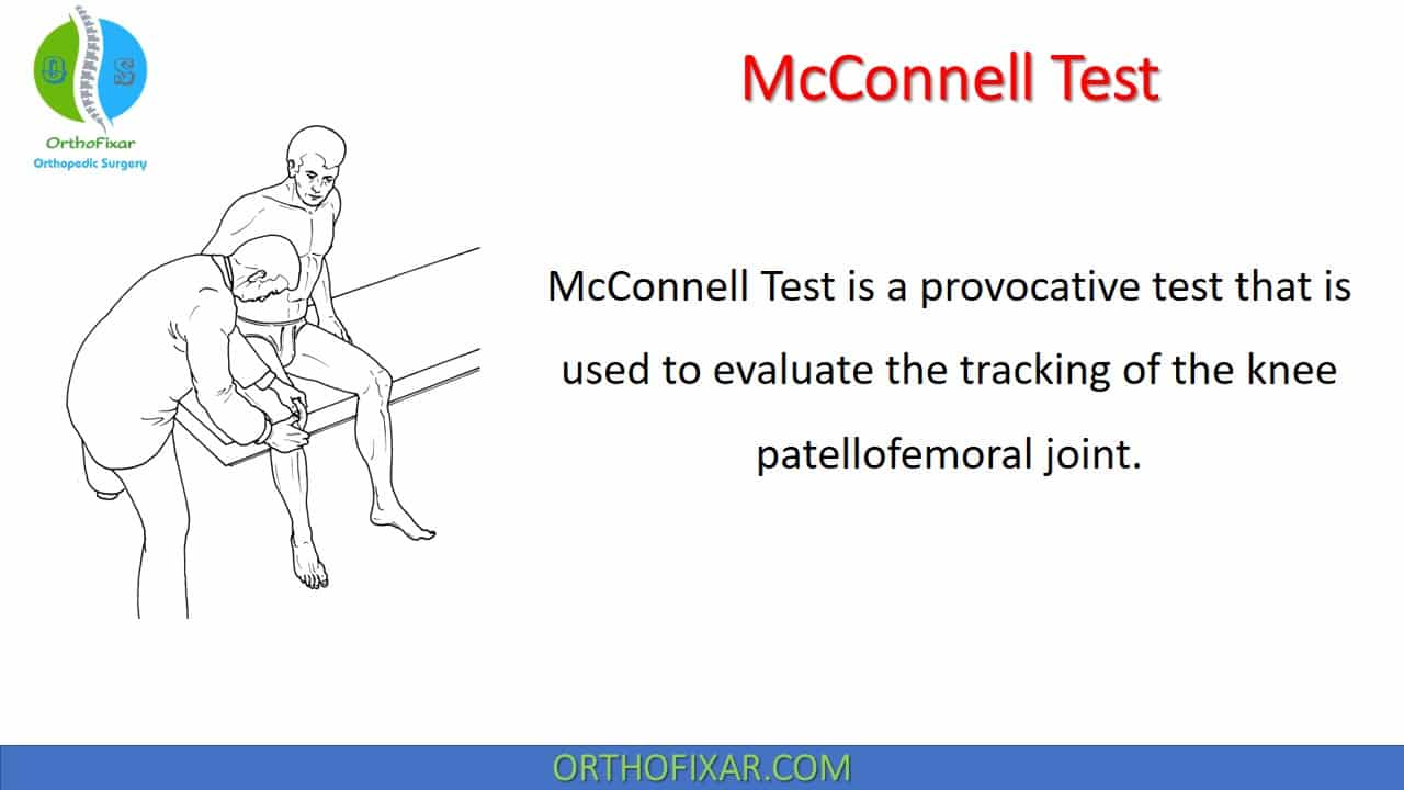 McConnell Test OrthoFixar 2024