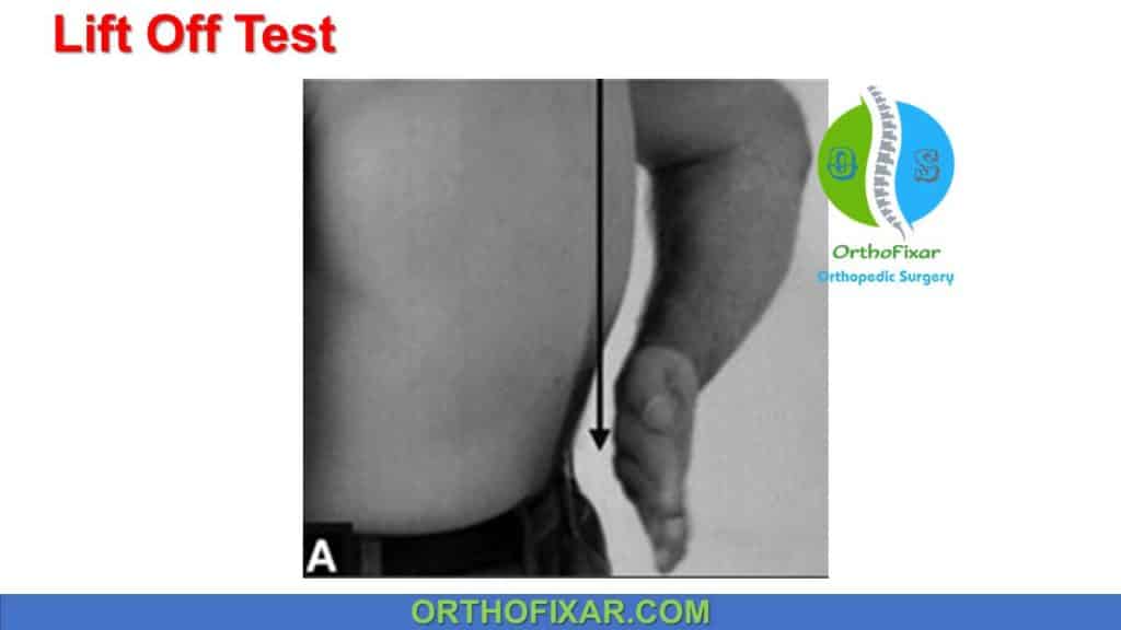 Lift Off Test • Easy Explained OrthoFixar 2024