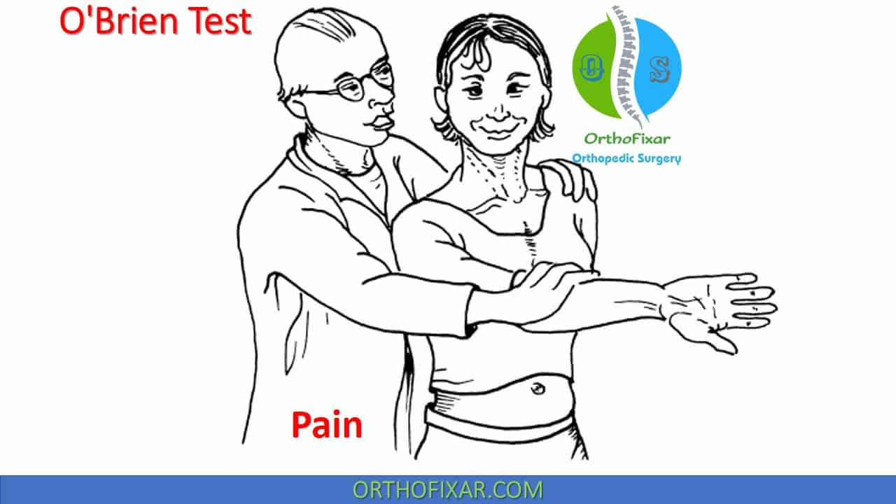 O'Brien Test Active Compression Test OrthoFixar 2024