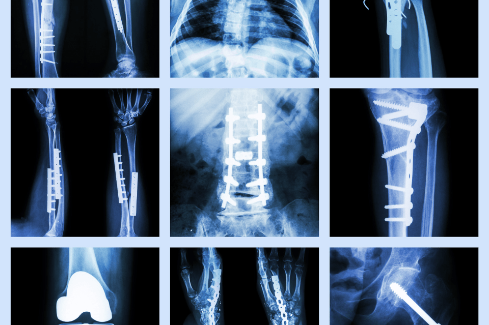 Orthopedic Surgery Information For Students 2024