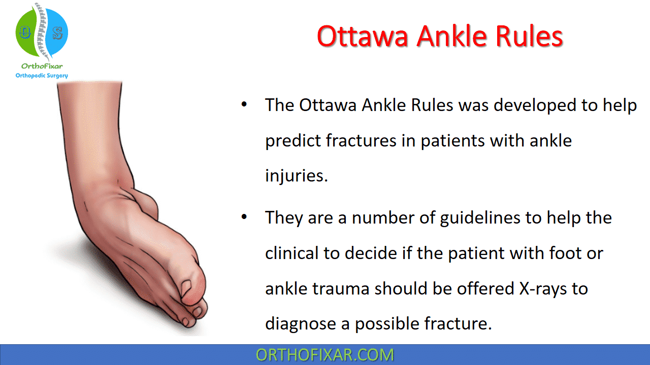 Ottawa Ankle Rules OrthoFixar 2024