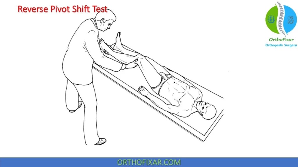 Reverse Pivot Shift Test OrthoFixar 2024