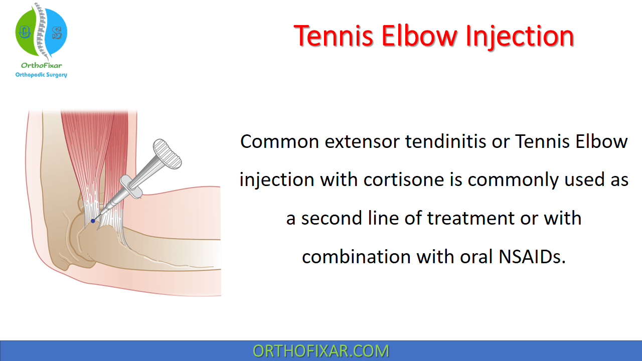 Prolotherapy Injection Technique Of The Elbow Journal Of
