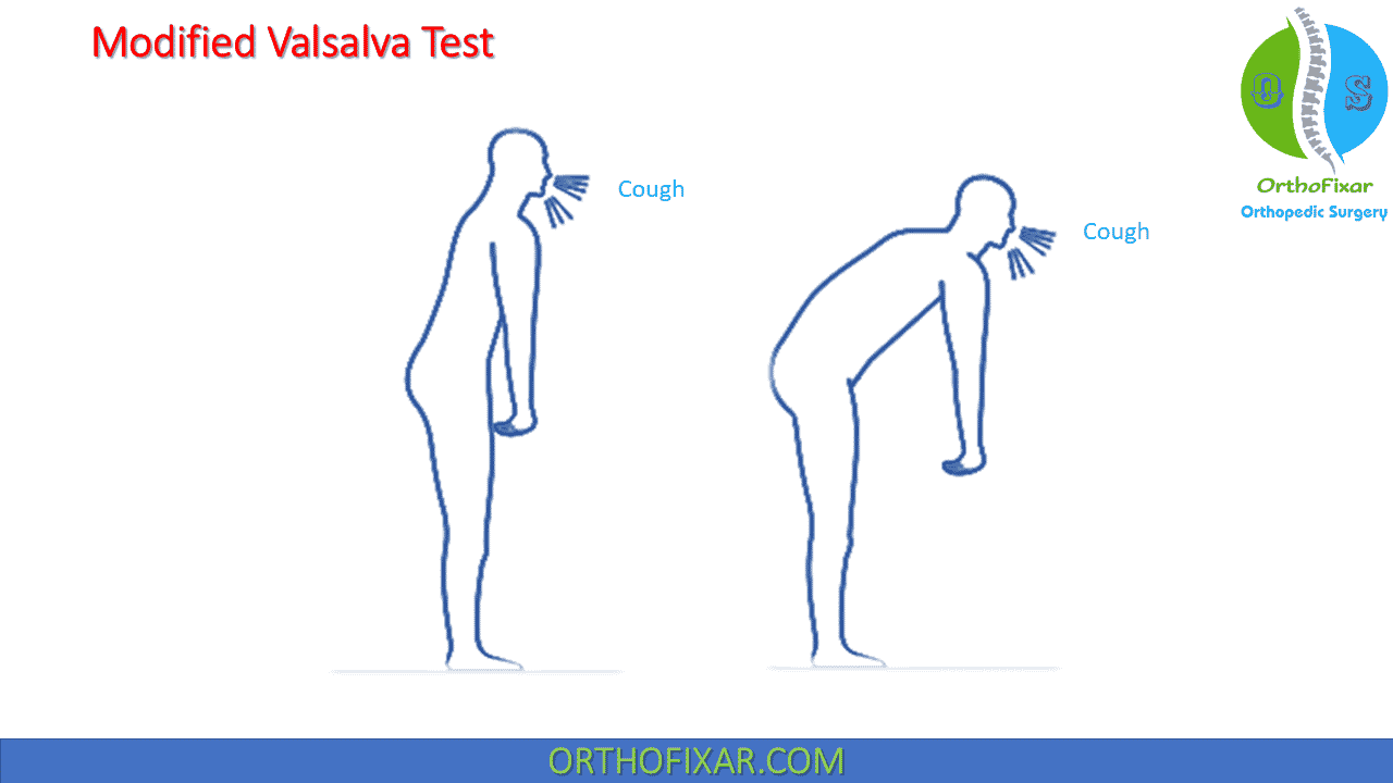 Valsalva Test Procedure Overview 2024