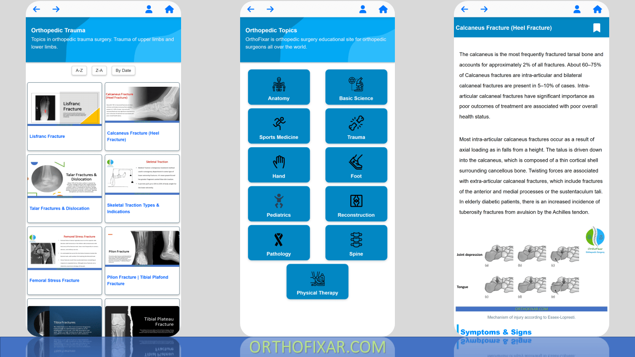 Orthofixar Orthopedic App OrthoFixar 2024