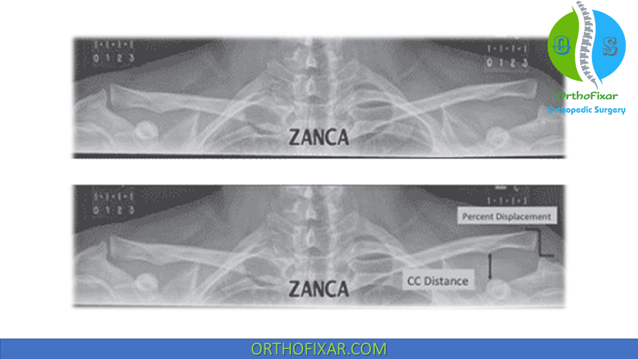 Zanca View X Ray