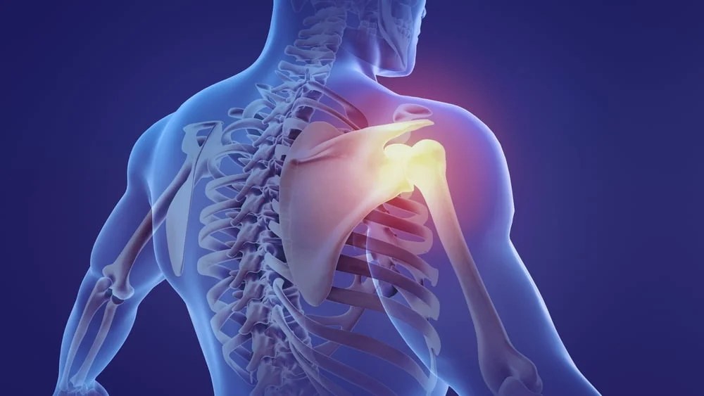 Shoulder Fracture Types, Symptoms & Treatment Zealmax Innovations