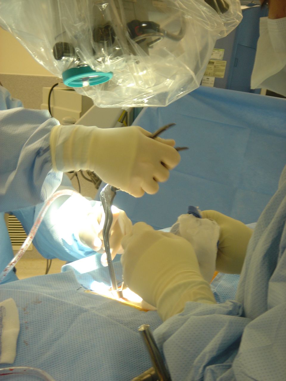 Minimally Invasive Spine Surgery OrthoInfo AAOS