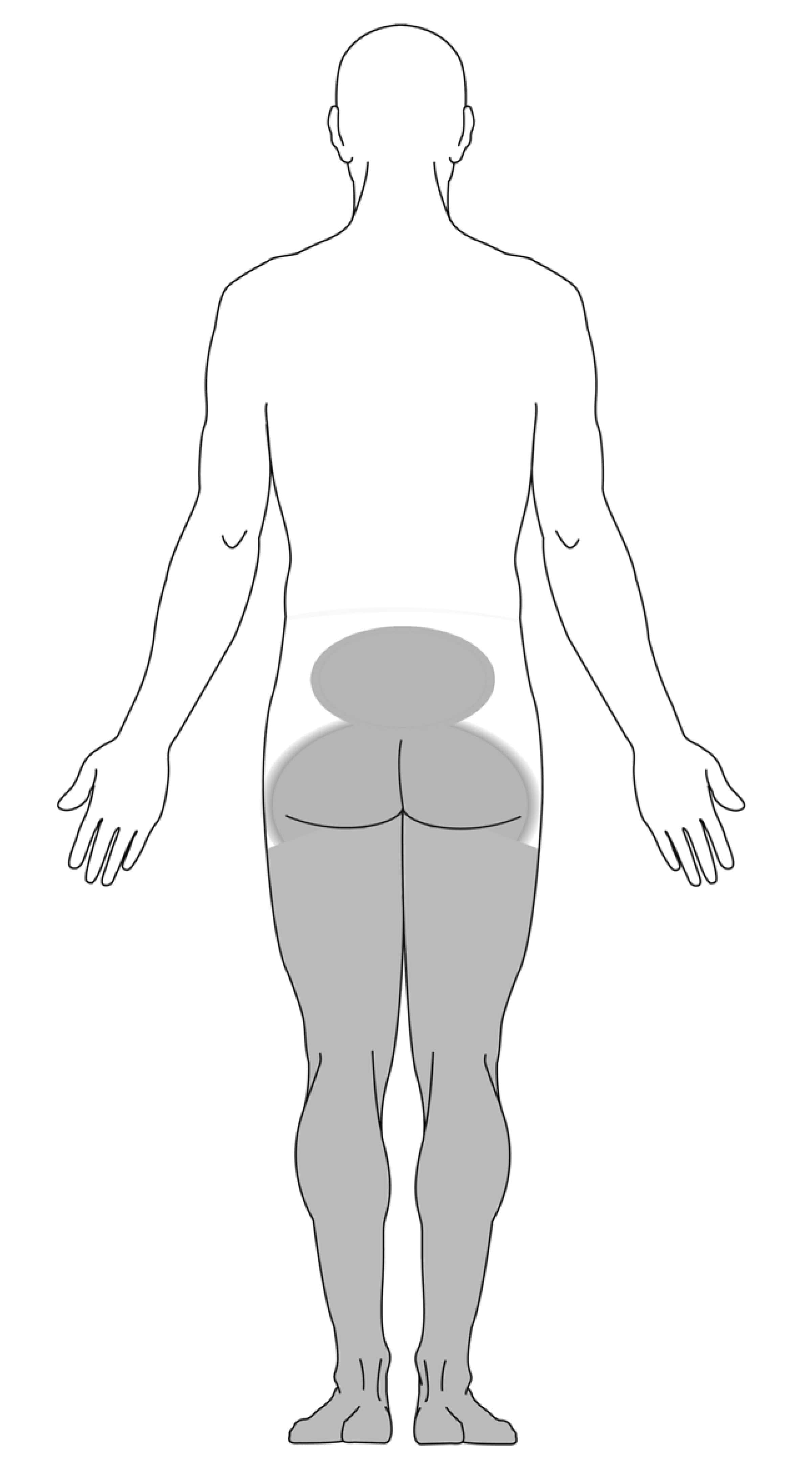 Cauda Equina Syndrome OrthoInfo AAOS