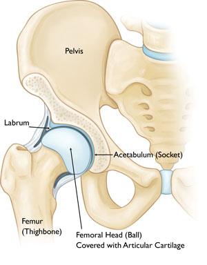 Hip Dislocation - OrthoInfo - AAOS