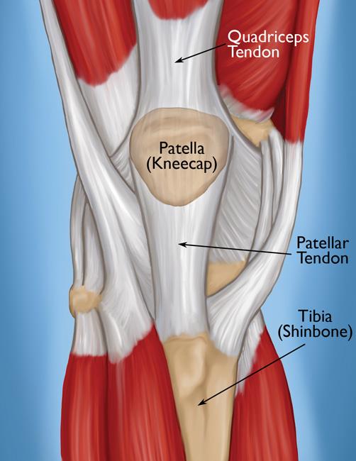 Patellar Tendon Tear OrthoInfo AAOS