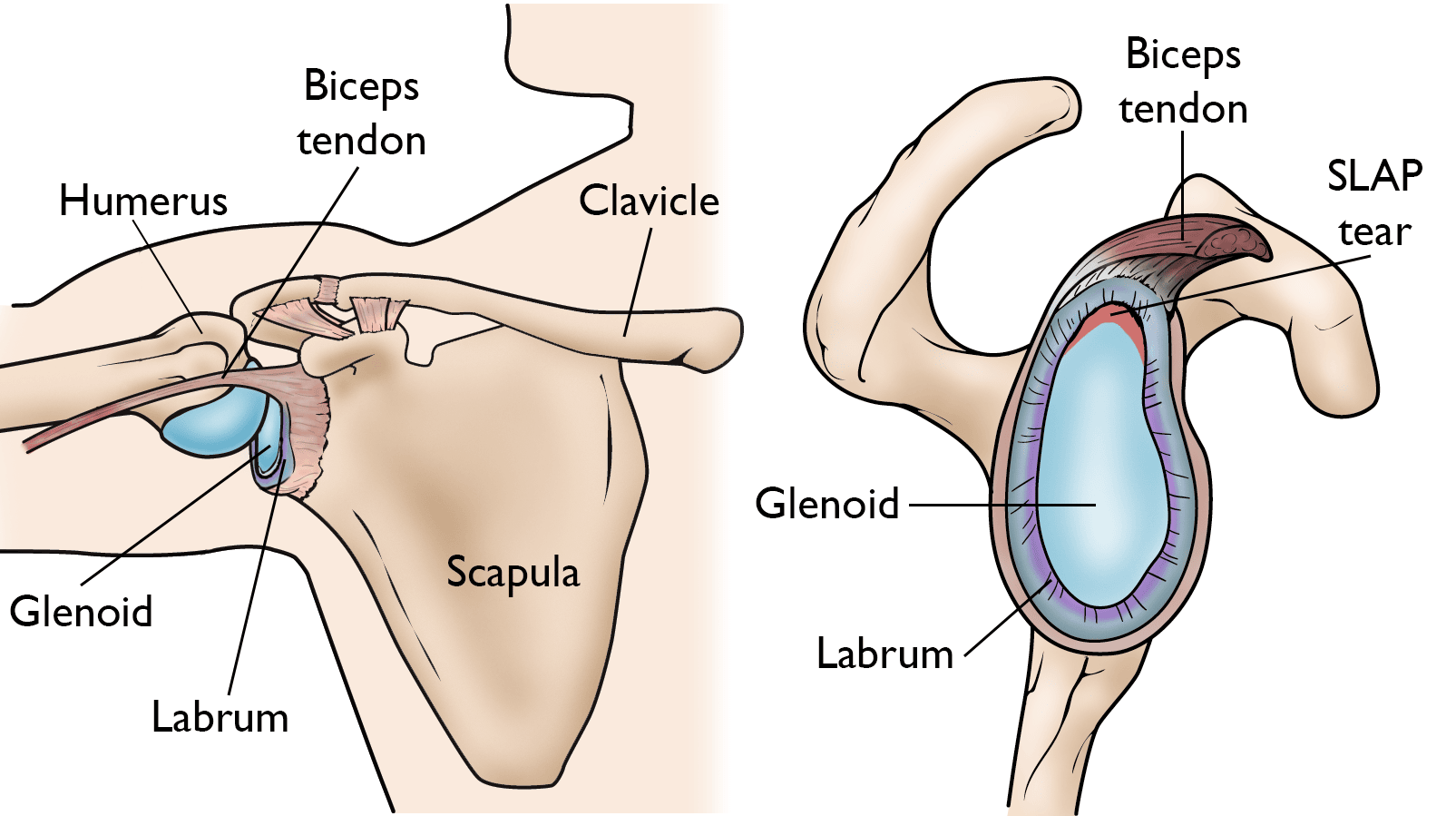Shoulder Injuries in the Throwing Athlete OrthoInfo AAOS
