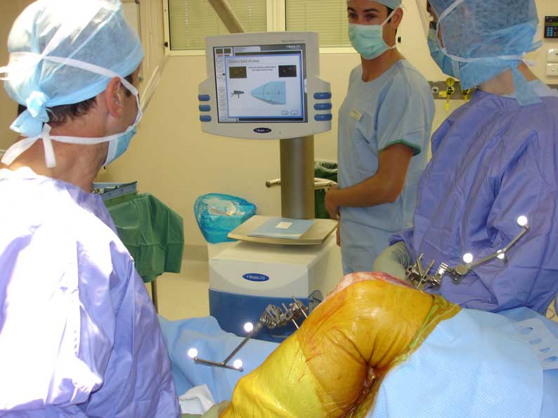 Robotic Surgery and Computer Navigation in Orthopaedics
