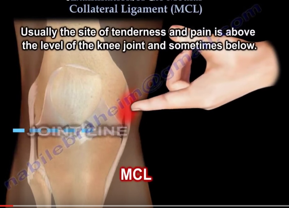 Examination of the Medial Collateral Ligament of the Knee