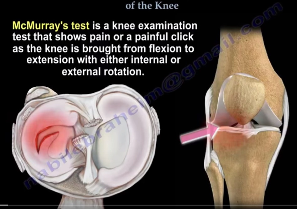 Knee Evaluation Tests —
