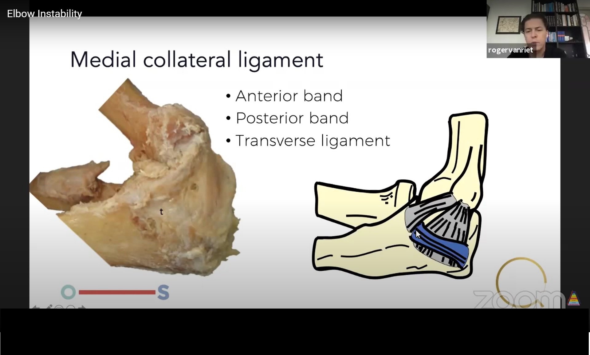 Elbow Instability —