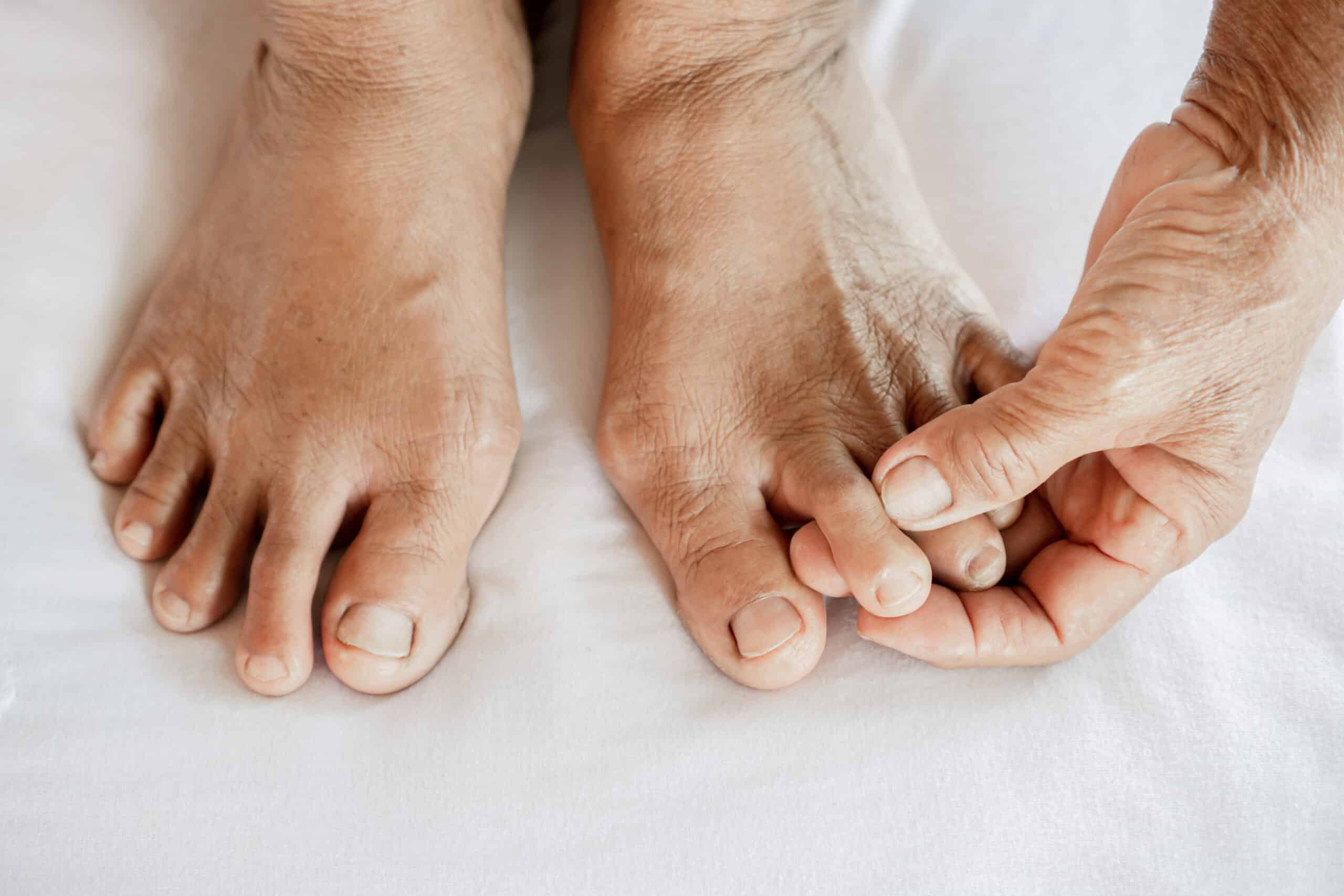 Foot & Ankle Arthritis Orthopedic Solutions OKC