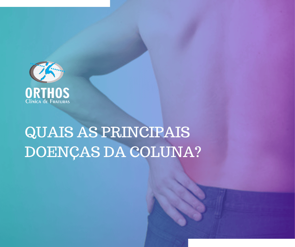 Confira as principais doenças da coluna. Orthos Clinica