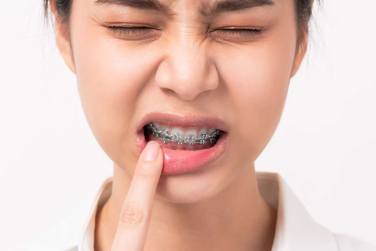 Managing Pain and During Orthodontic Treatment