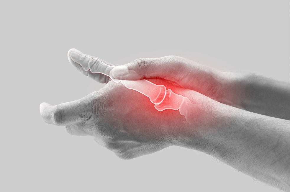 Trigger Finger Symptoms, Causes, & Treatment
