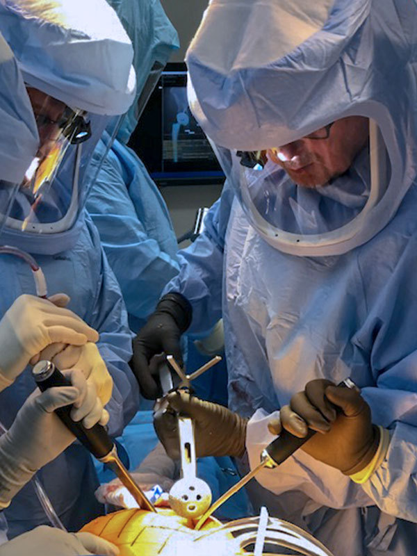 Hip Replacement Surgery Performed with Alteon Cup, XLE Liner OR Today