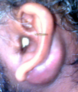 Osce Notes In Otology Cases Osce Notes In Otolaryngology