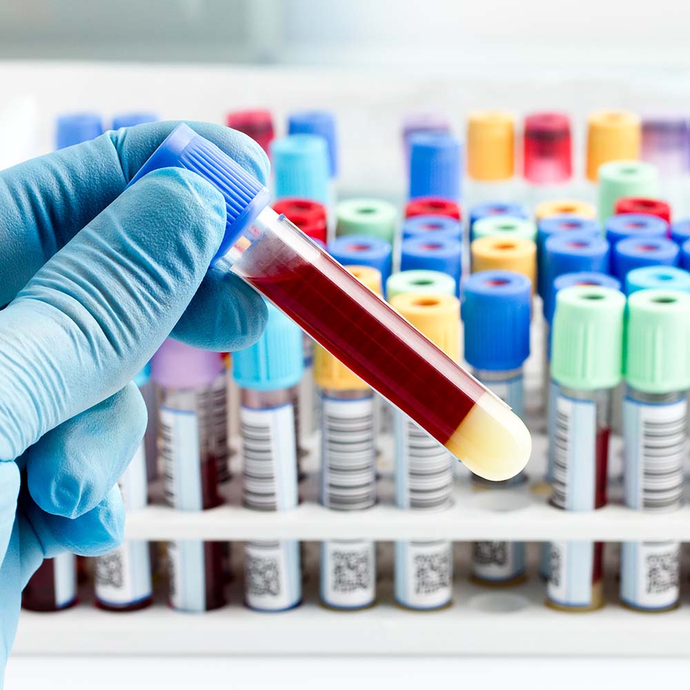 What You Need to Know About Blood Borne Diseases in the Workplace Part