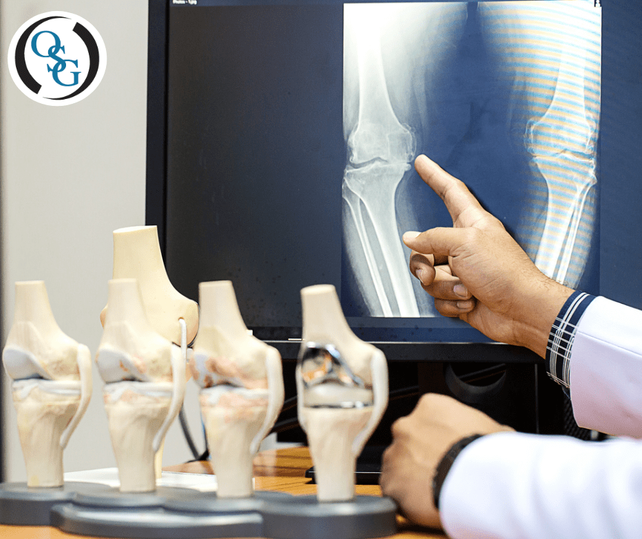 4 Signs You Should Visit An Orthopaedic Doctor Orthopaedic Specialty