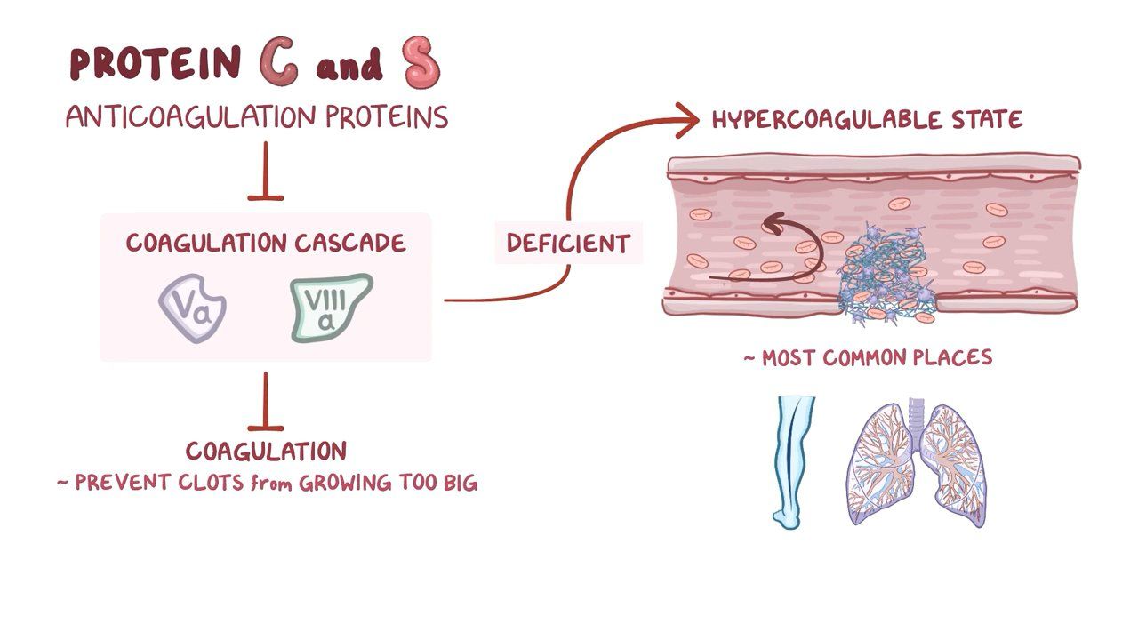 How Common Is Protein C Deficiency at Demetra Yu blog