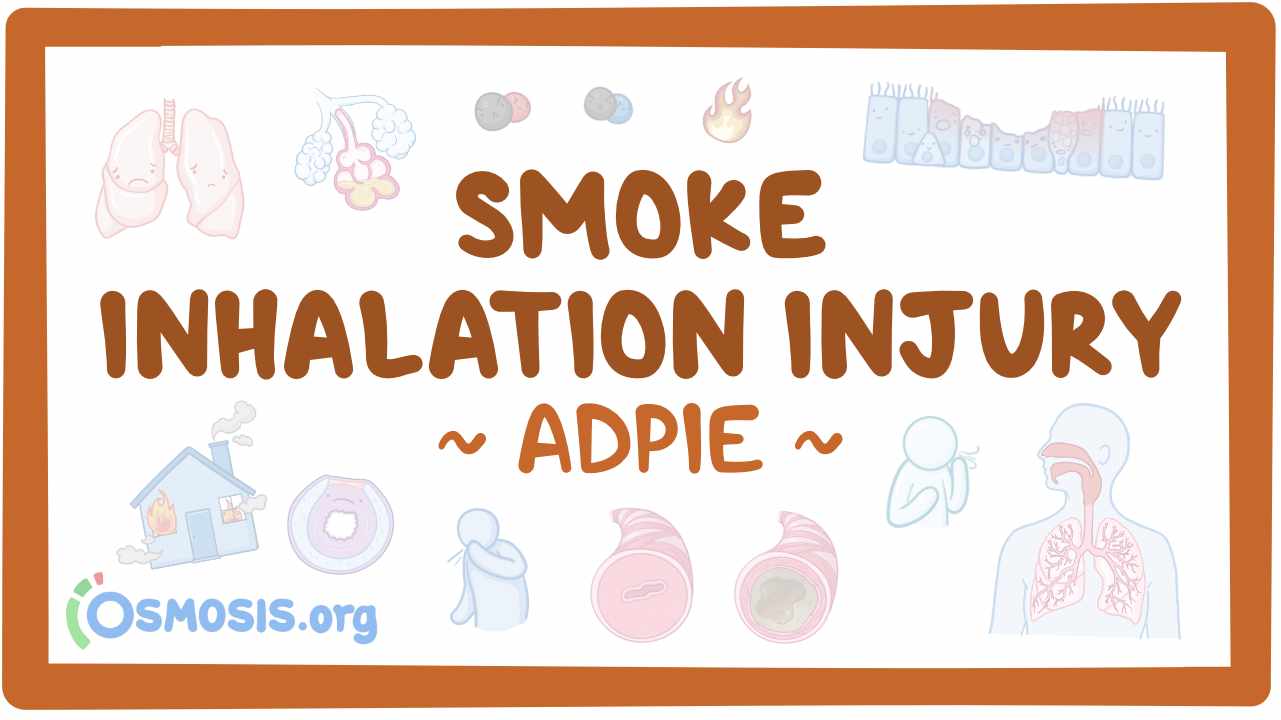 Smoke inhalation injury Nursing process (ADPIE) Osmosis Video Library