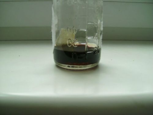 Normal color of urine Medical diagnosis