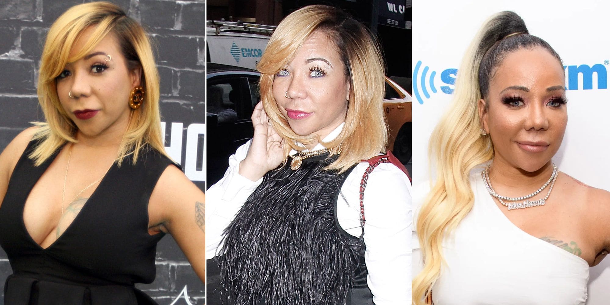 Tiny Harris Before and After Plastic Surgery