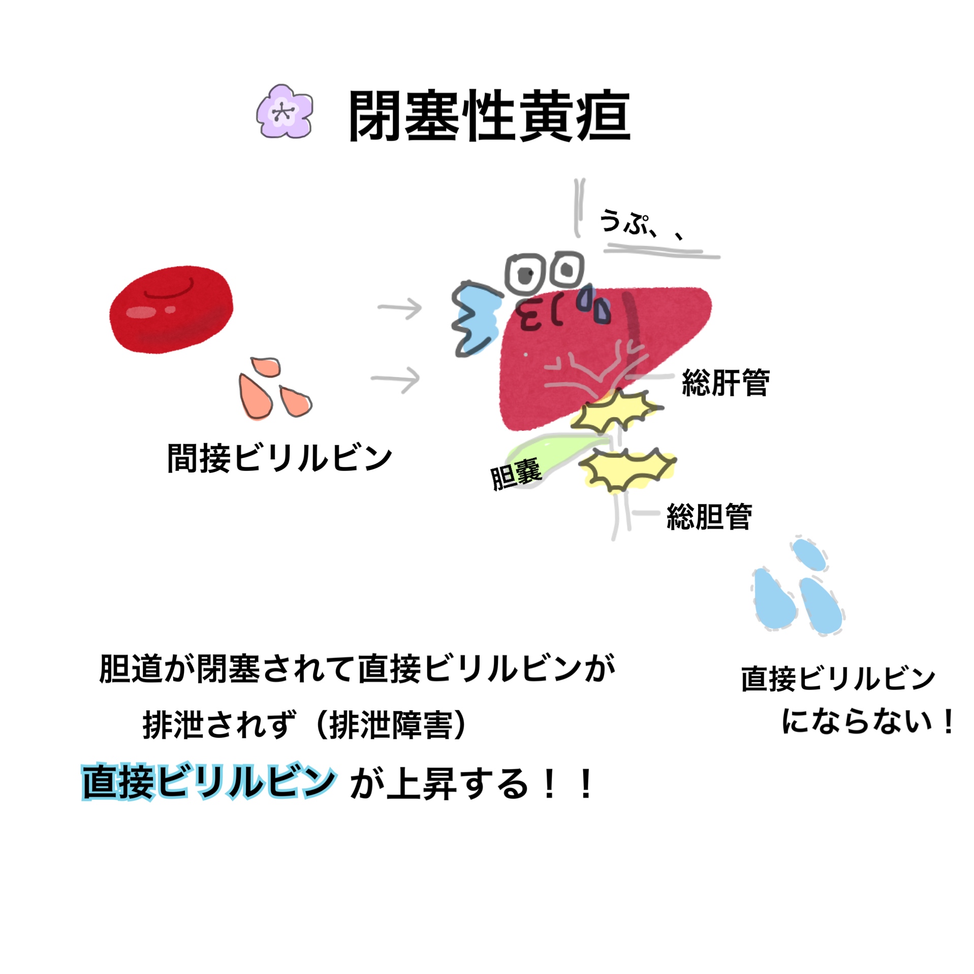 黄疸について② 看護学生のお手伝いマン