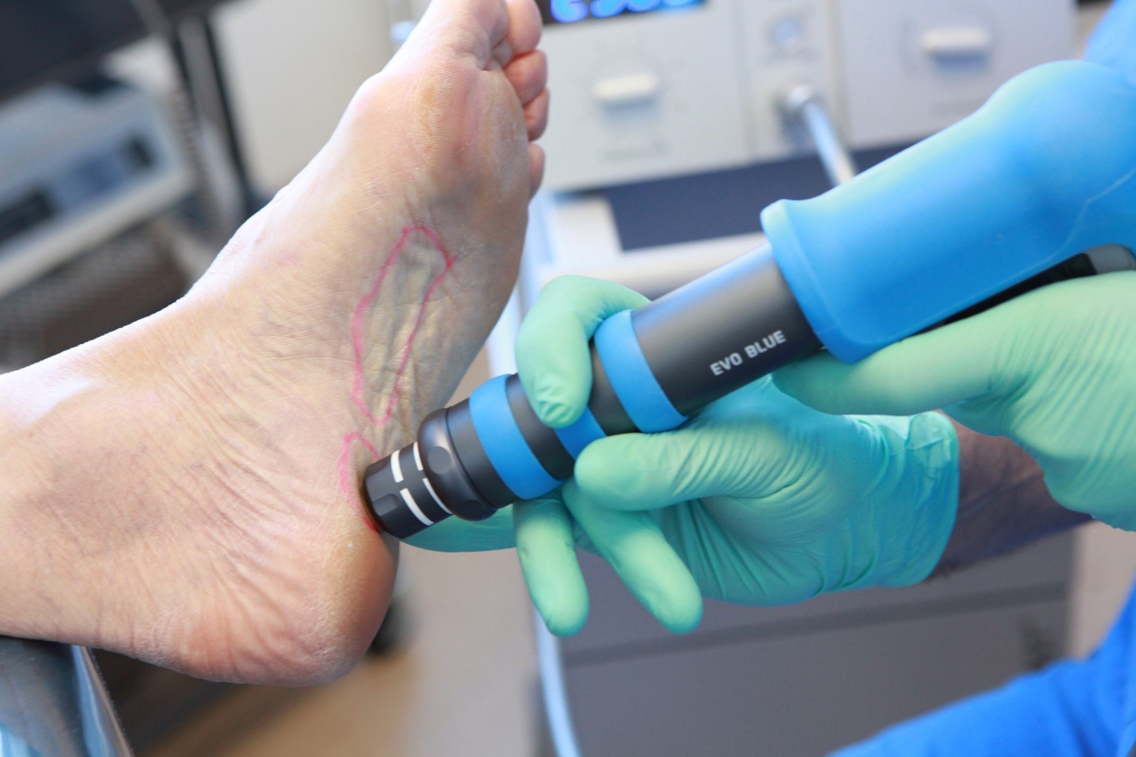 Ottawa Foot Clinic LongLasting Solutions For Your Foot And Toenails