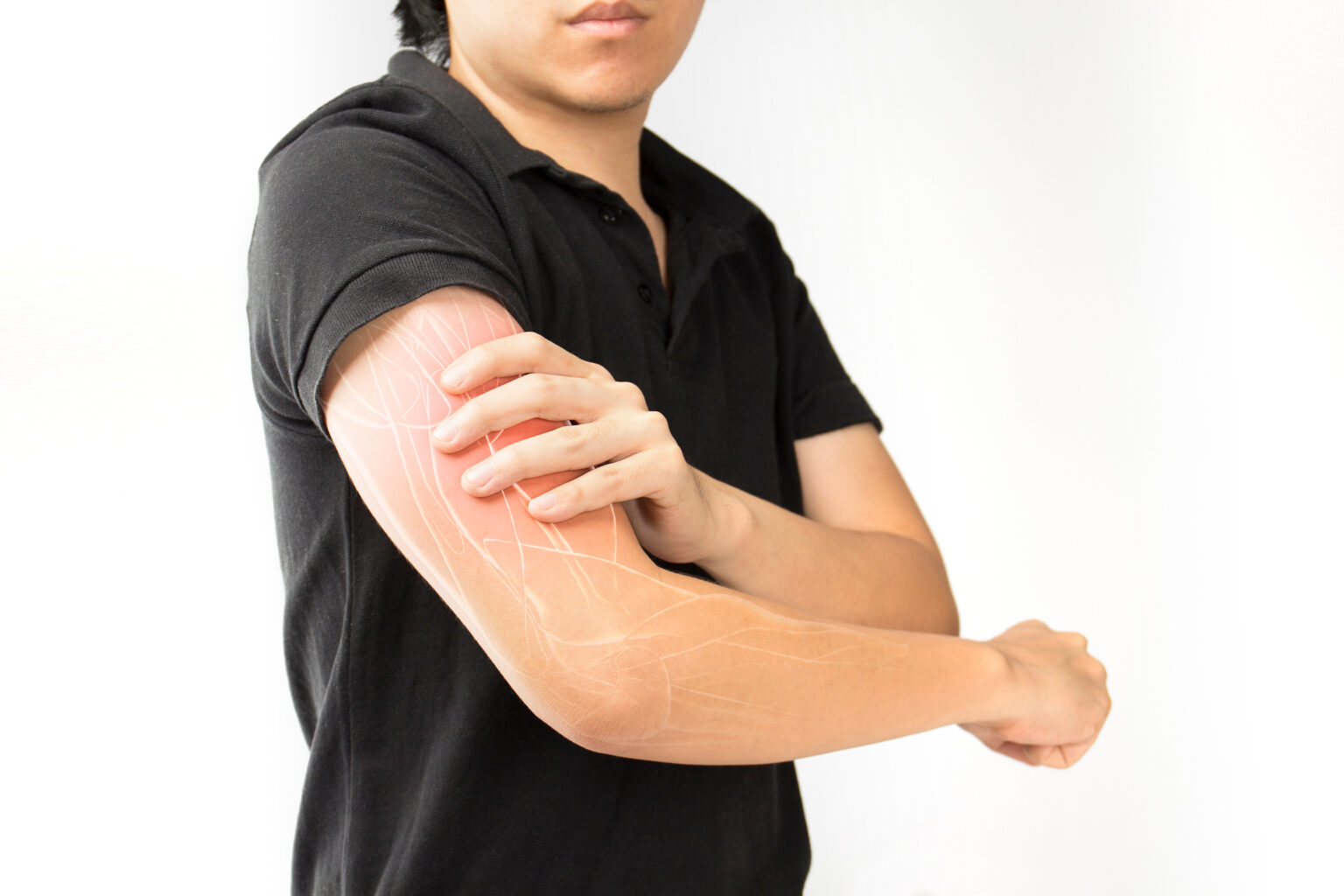 Thoracic Outlet Syndrome and nerve compression Ashby House Massage