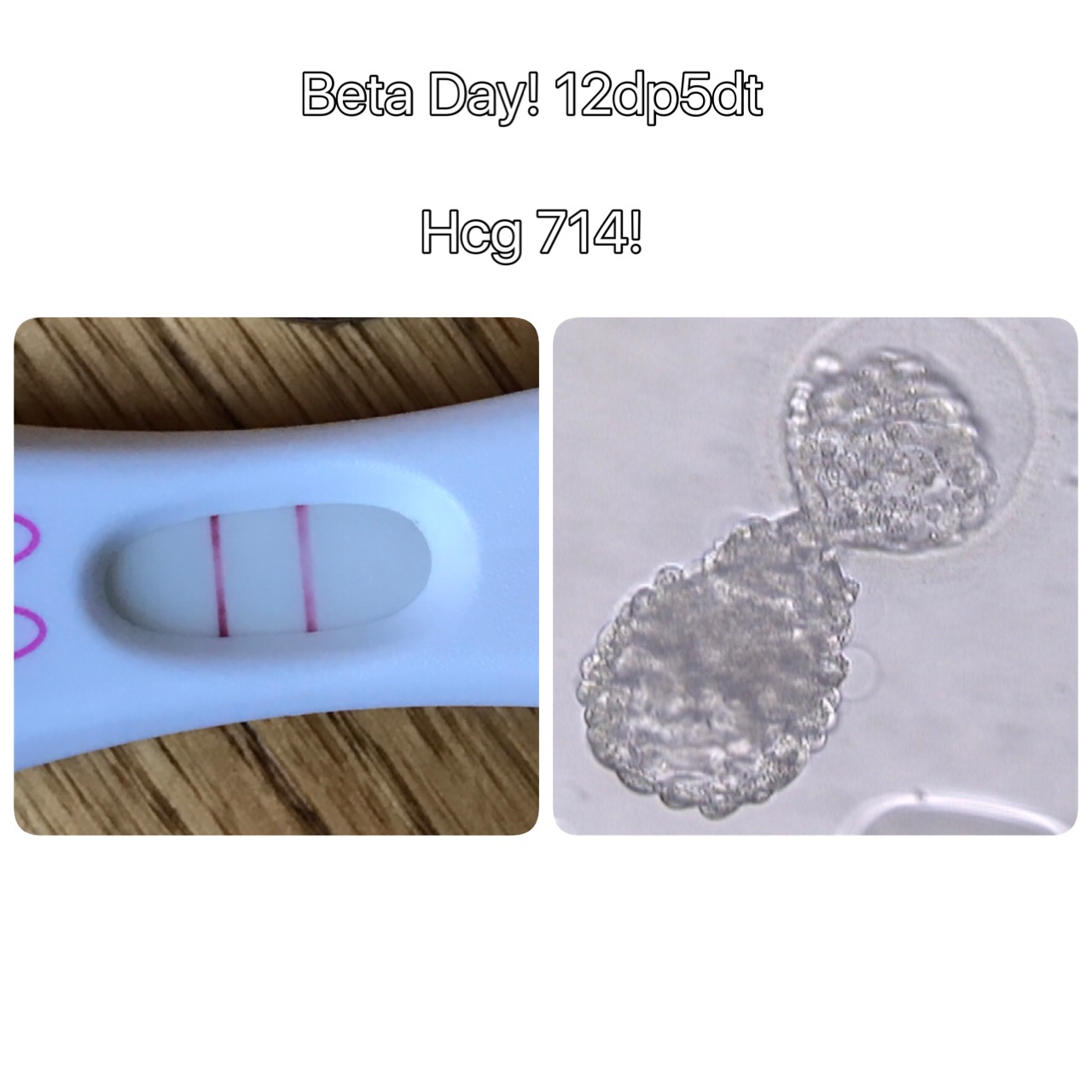 Surprise! We’re Having a Baby!