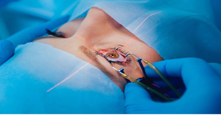 Top Rated LASIK and Best Cataract Surgery Centers in Evansville