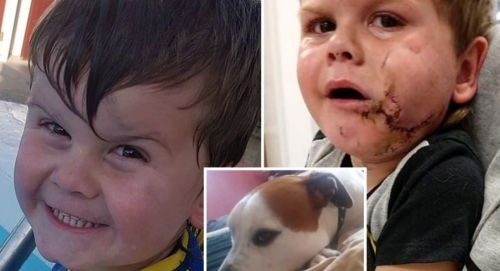 Un petit garçon de 2 ans se fait déchiqueter le visage par le chien de la famille