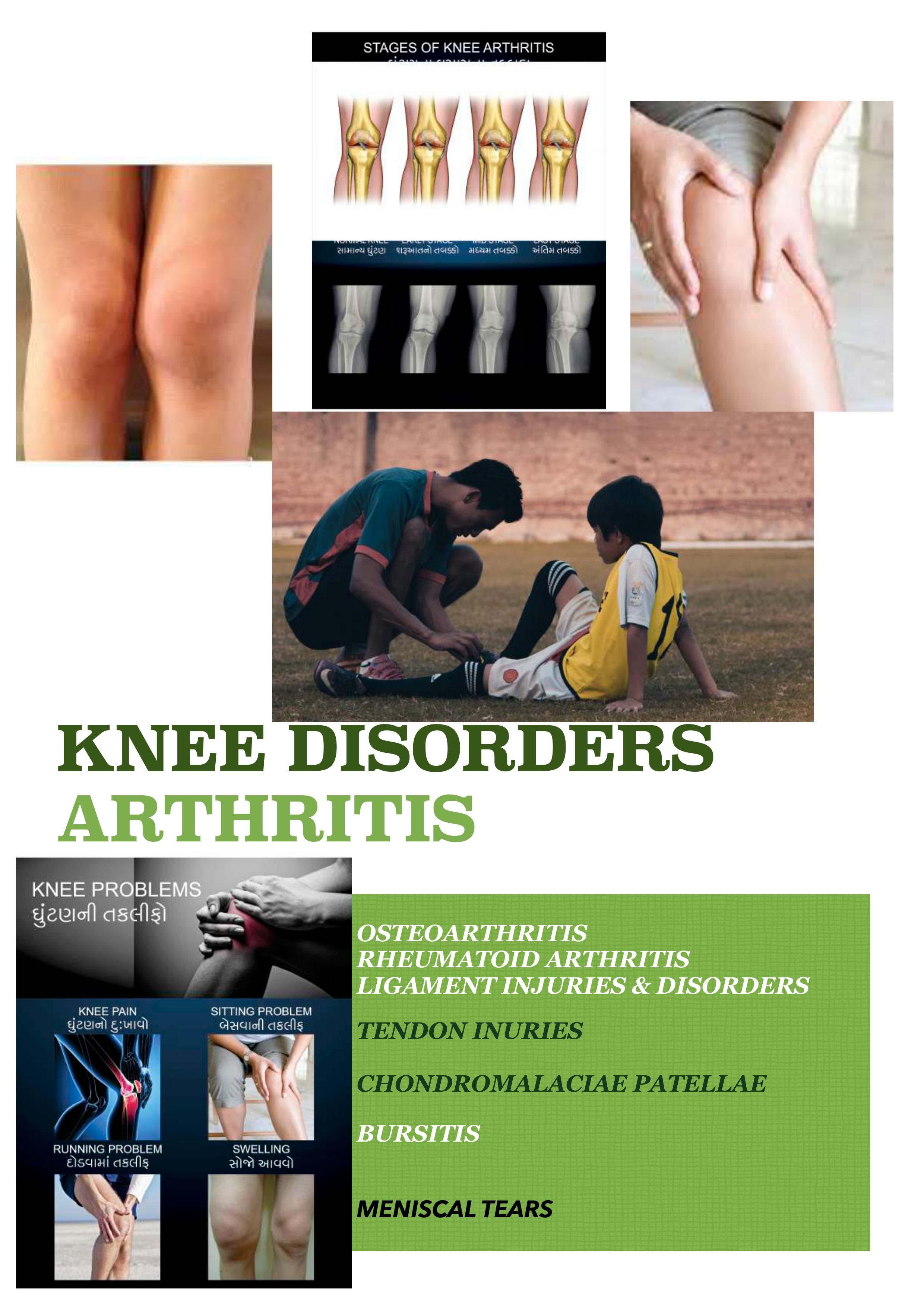 Knee Disorders Arthritis Ozone Therapy Clinic / Hospital