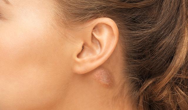What You Need To Know About That Lump Behind Your Ear_国际_蛋蛋赞