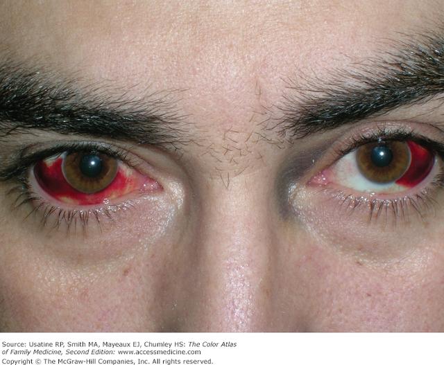 6 HORRIFYING cocaine abuse Side effects!!_国际_蛋蛋赞