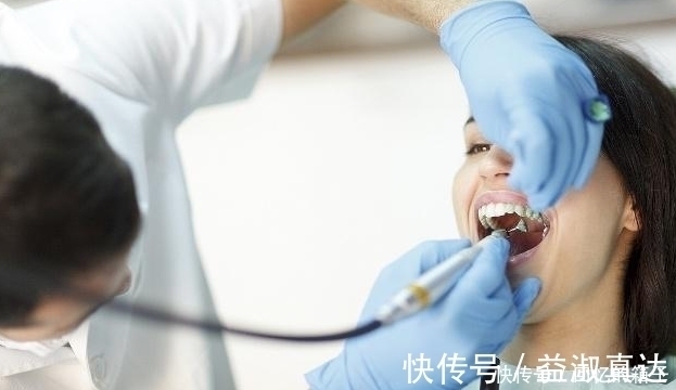 牙龈炎洗完牙多久能好