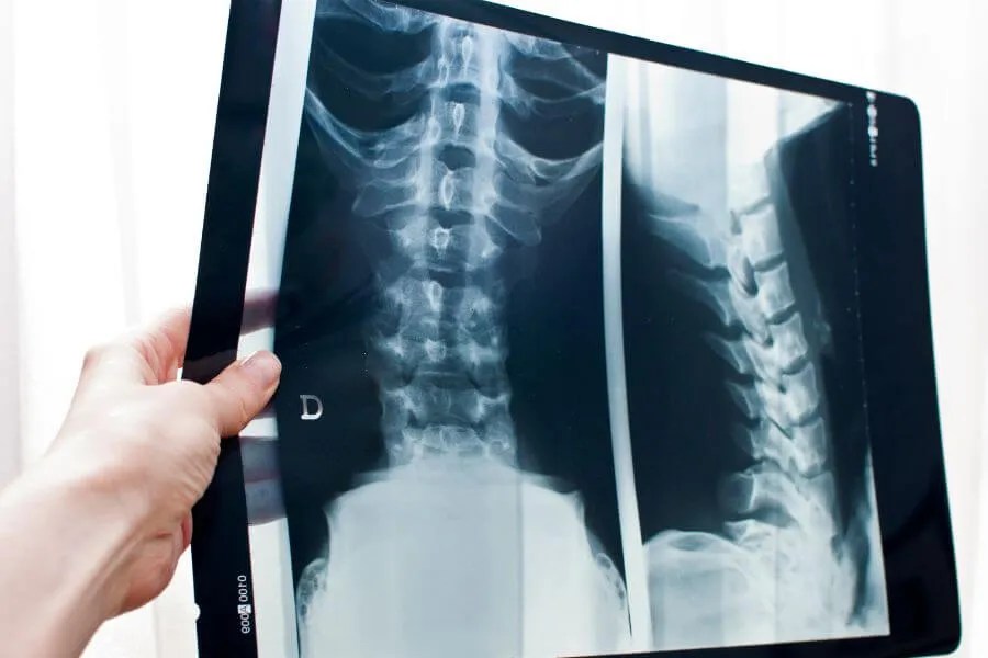 Should You Get An MRI Before Starting Physical Therapy?