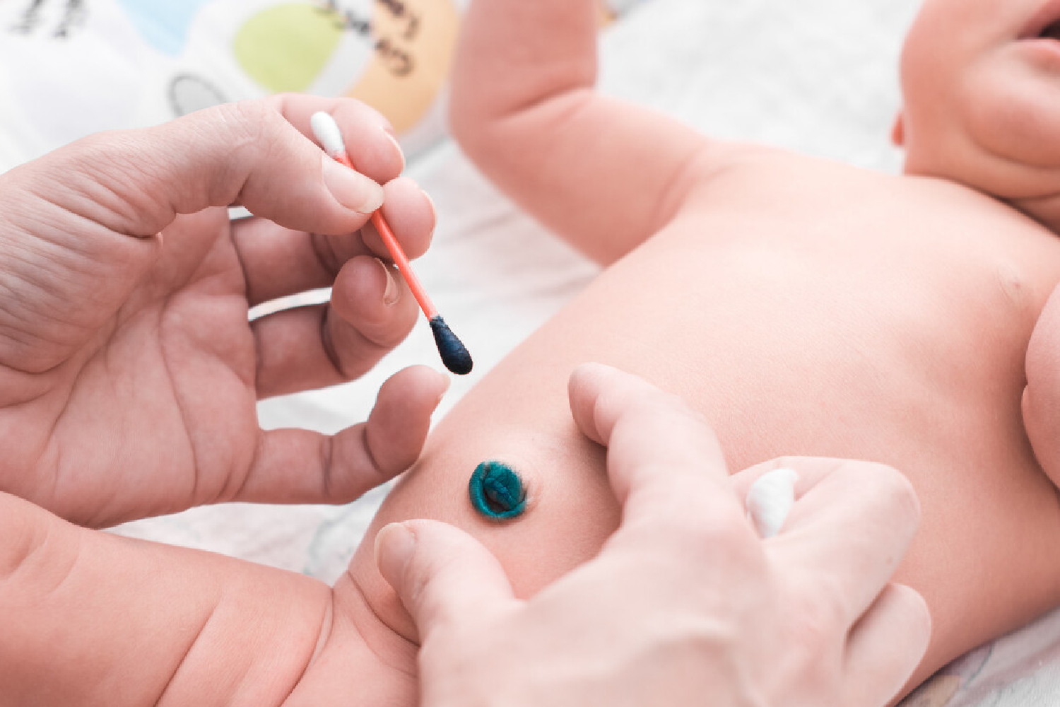 Denk Je Dat Je Alles Weet Over De Navel Van Je Baby? | Moeders Vandaag