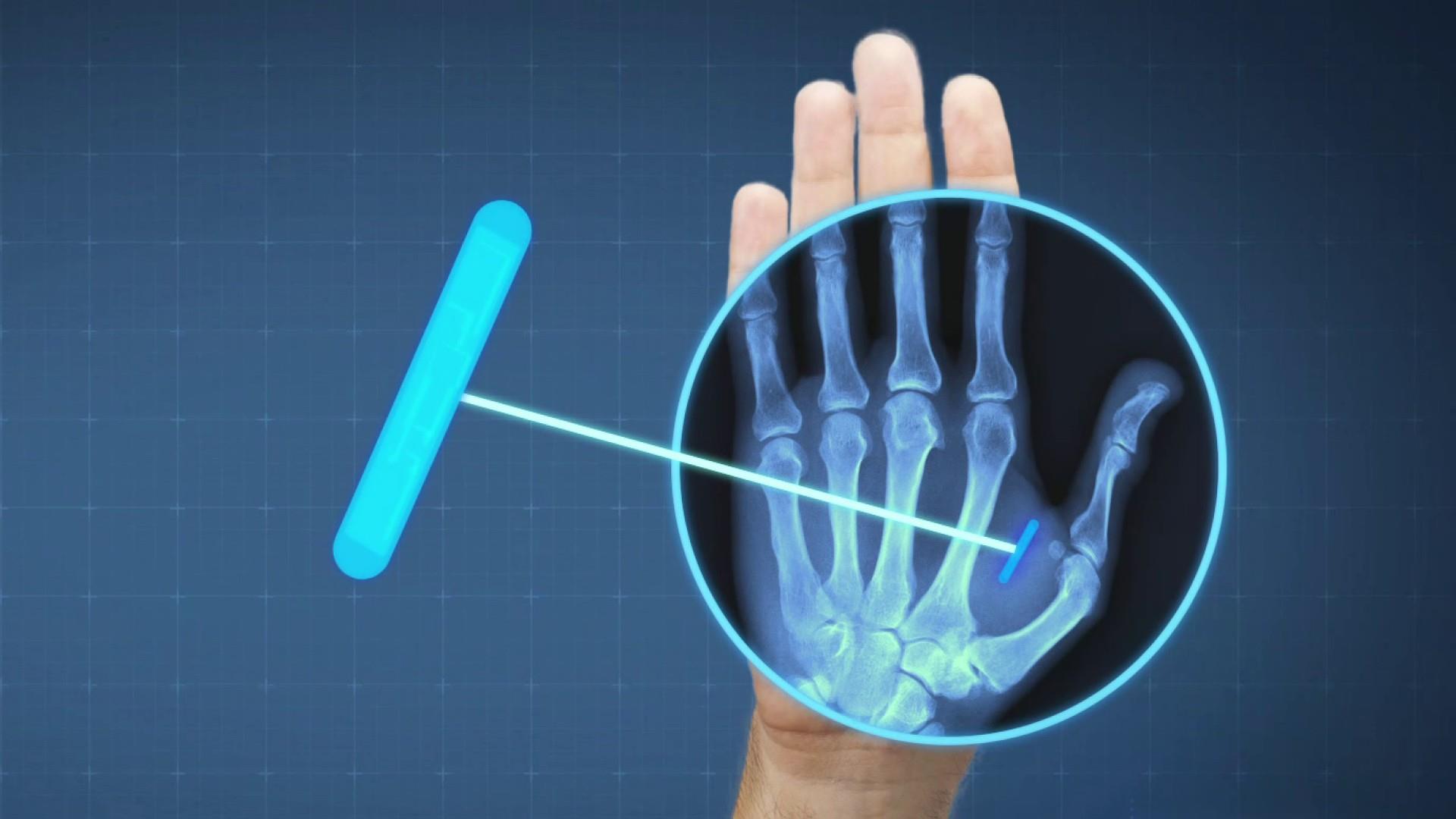 Implantes de Chips para el control total Pablo Munoz Iturrieta