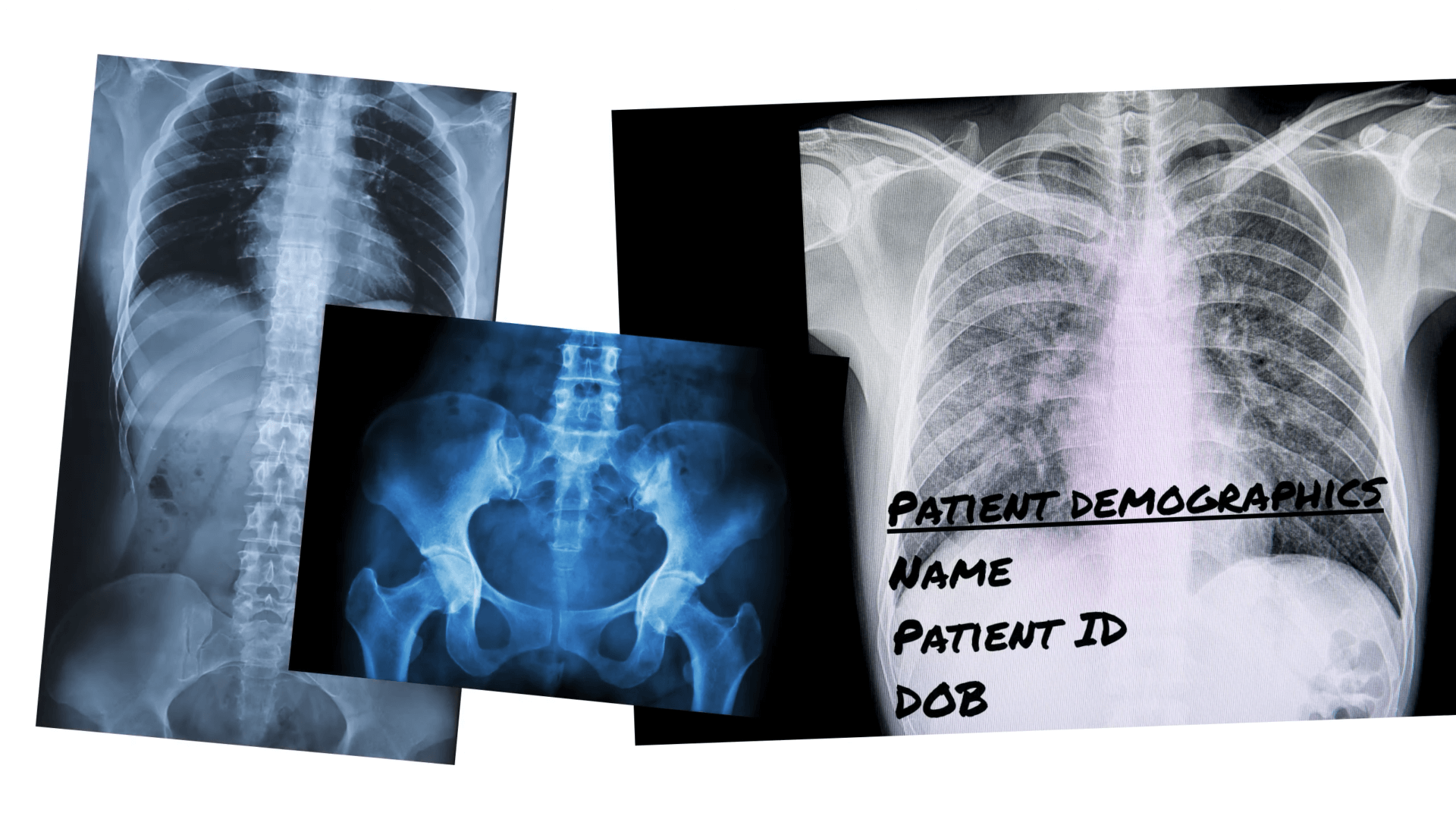 What is a Tag PACS Boot Camp