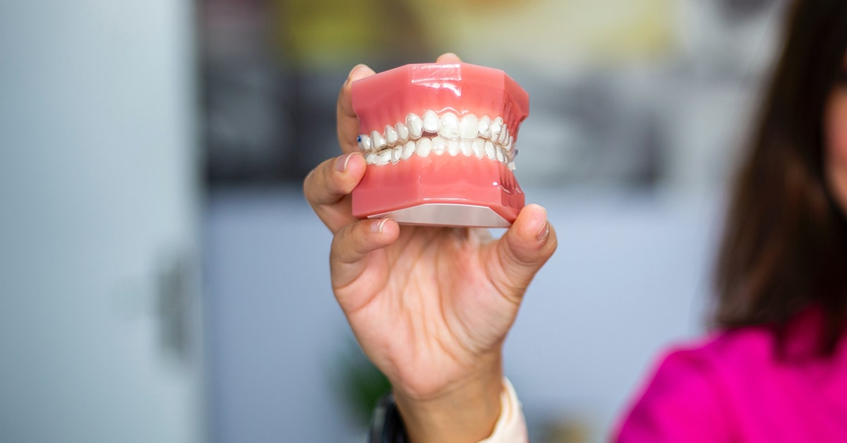 Can You Remove Dental Implants or Do They Stay in Your Mouth?