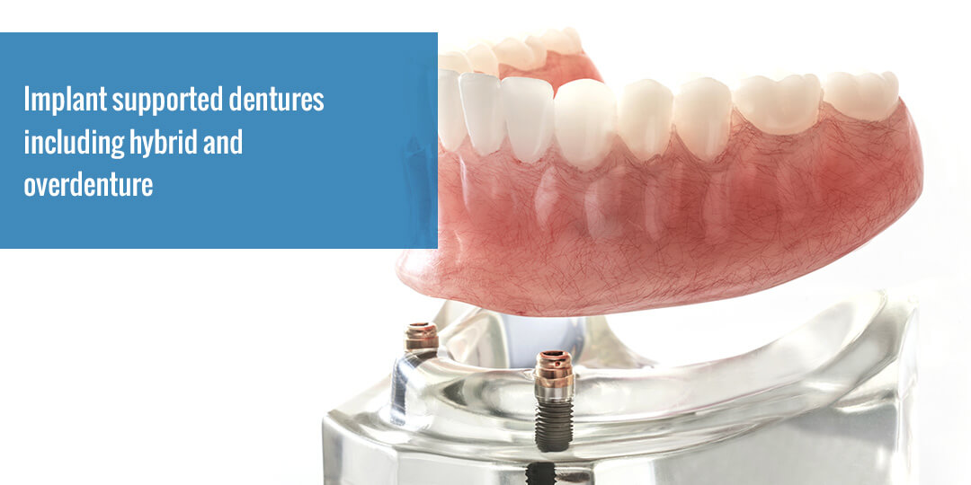 Precision Art Dental Lab Full Service